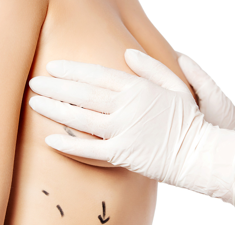 【抽脂體雕】抽脂術後照護為什麼術後摸起來會「硬硬的」？是副作用嗎？